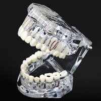 1 szt. Model dentystyczny Zęby Implant Przywrócenie mostu Badanie dydaktyczne Ząb Nauki medyczne Choroby dentysty Produkty stomatologiczne 4